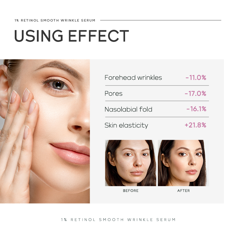 Siero Antirughe al 1% di Retin - The Ordinary Serum Hyaluronic Acid recensione e prezzo